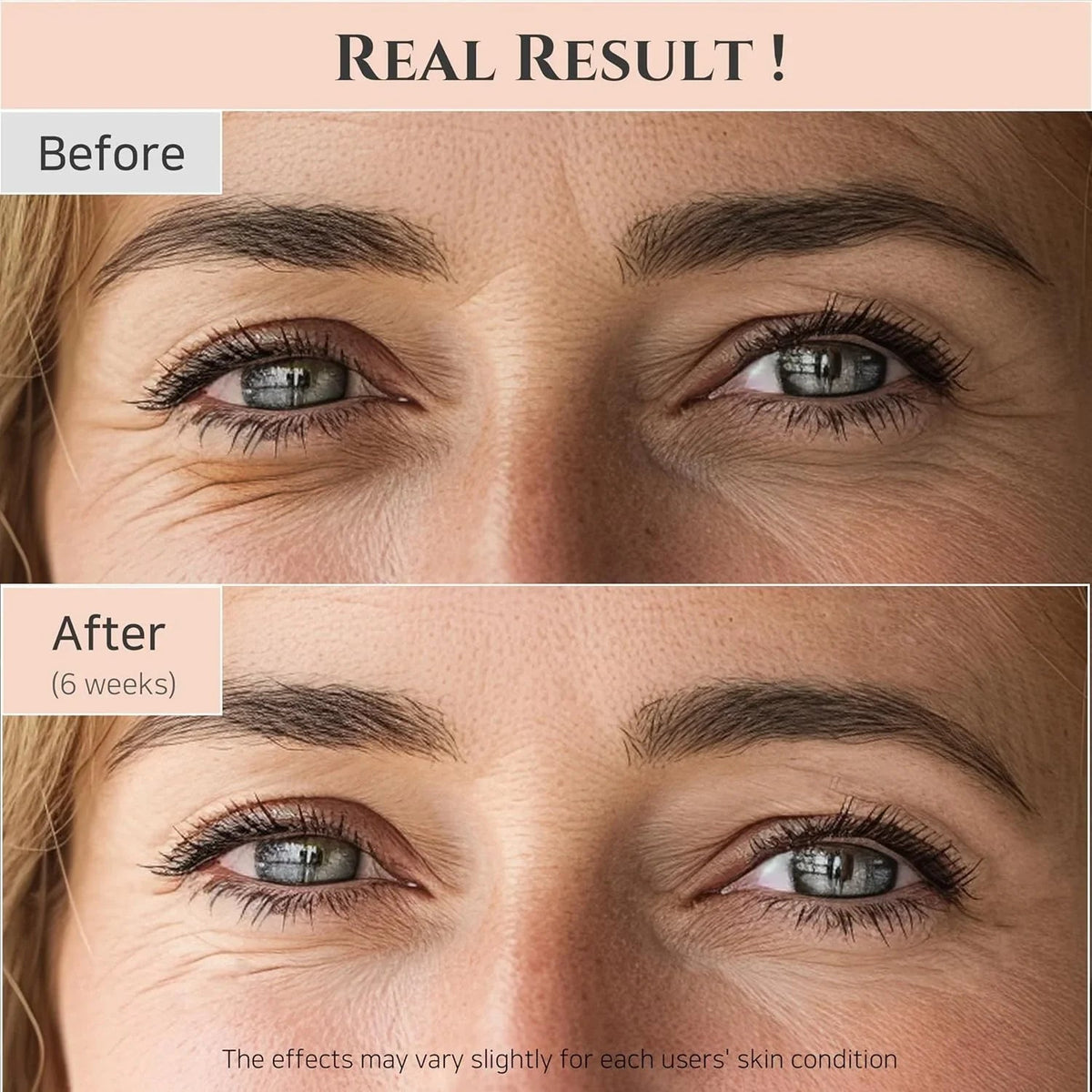 Beauty of Joseon Revive Eye Serum with Retinal Niacinamide Peptide for Face Under Eyes Wrinkles Dark Circles Moisturizer Cream Korean Skincare 30ml, 1 fl.oz * 2pack